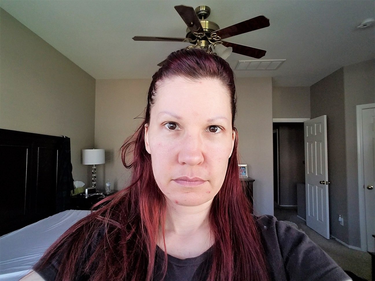 I Got a Liquid FaceLift - Was it Worth it? - Cheap and Cheeky