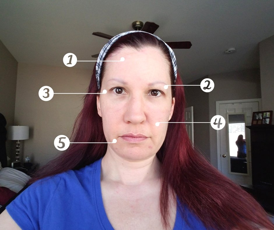 Here are my problem areas on my face that I want to fix