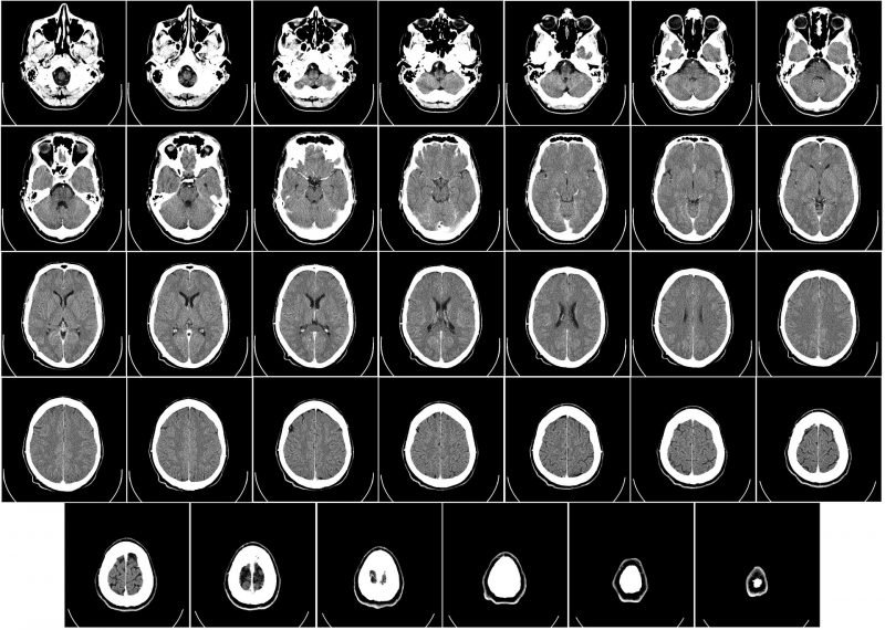 The CT scan was actually pretty cool 